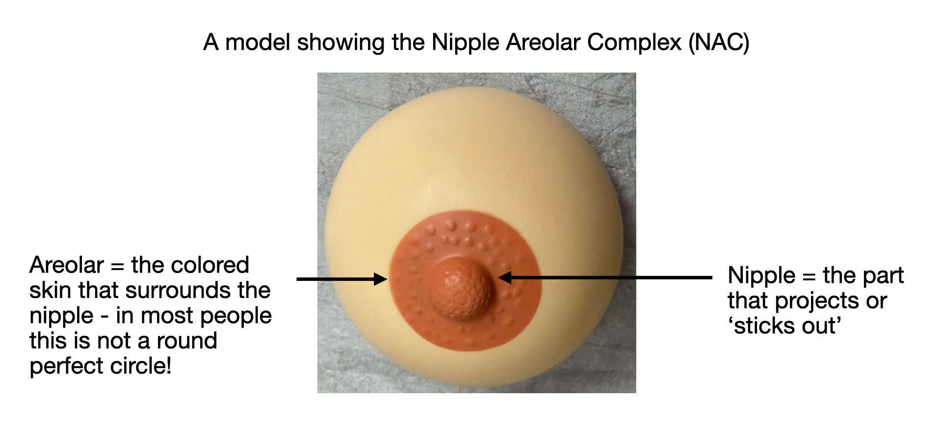 Nipple areola reconstruction surgical figure — LA Breast & Body